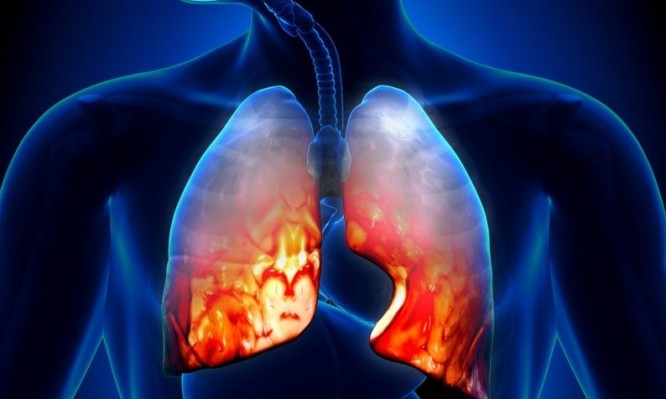 Πνευμονία : Τι πρέπει να γνωρίζουμε