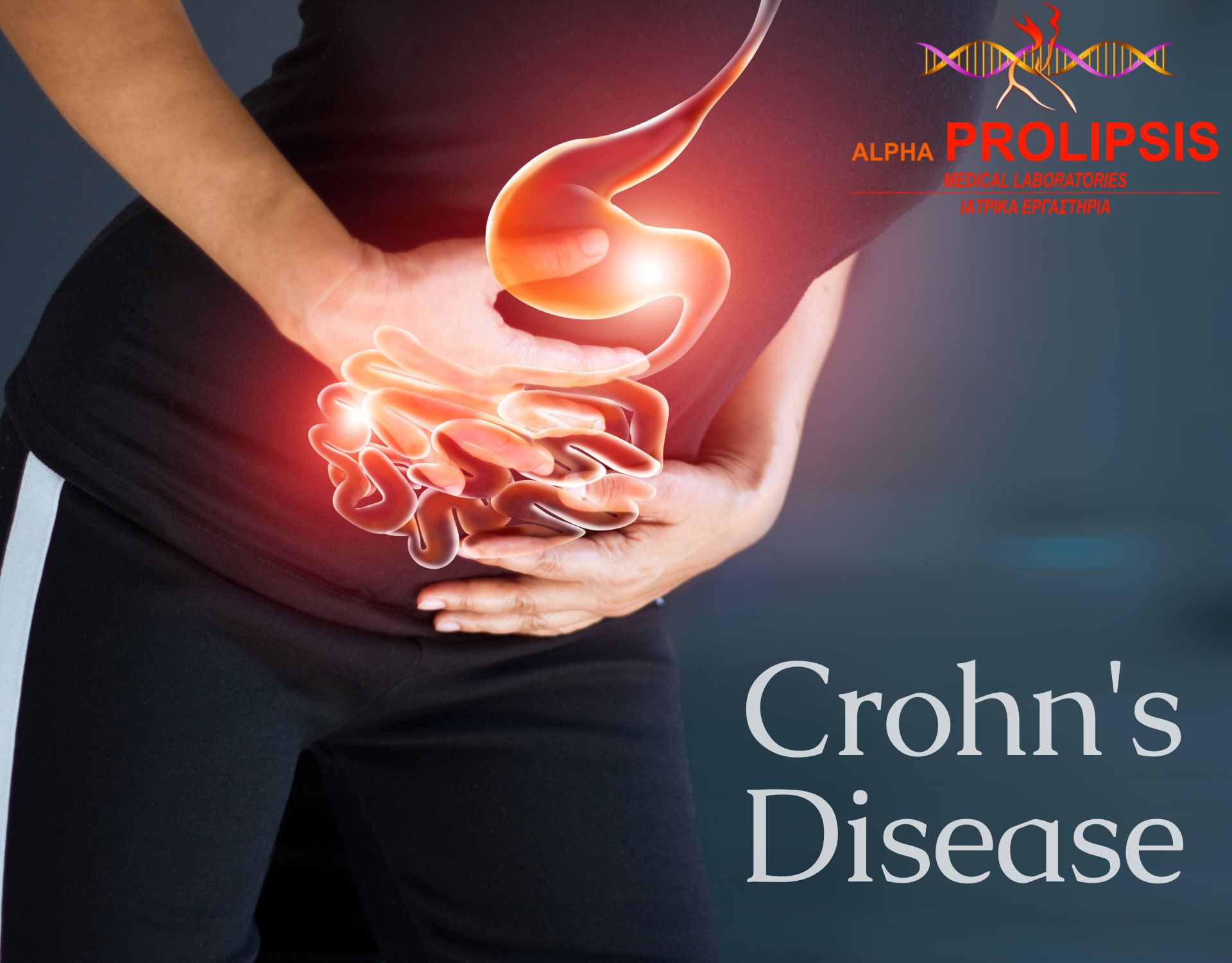 Nόσος Crown συμπτώματα θεραπεία εξετάσεις Alpha Prolipsis Nόσος Crown συμπτώματα θεραπεία εξετάσεις