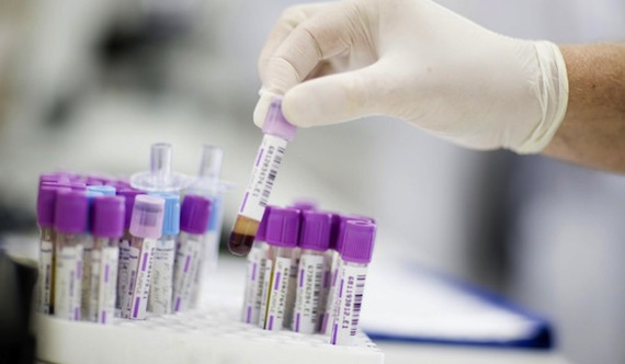 καρκινοεμβρυϊκό αντιγόνο- CEA