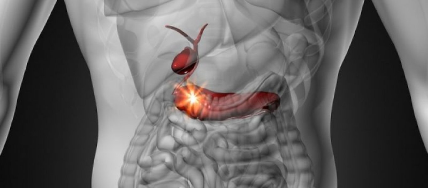 Ποια είναι τα σημάδια του καρκίνου στο πάγκρεας