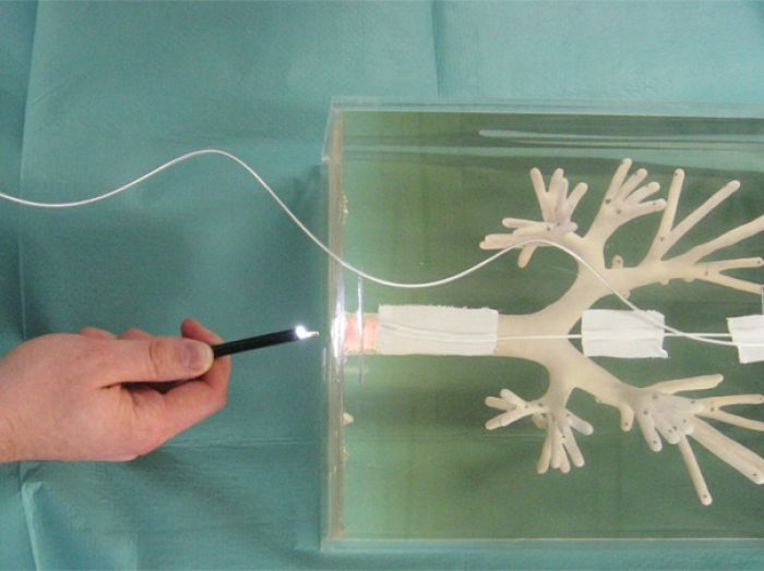 Η βρογχοσκόπηση