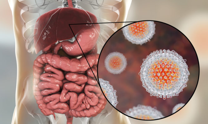 Ηπατίτιδα C