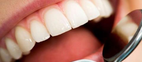 Πώς να αφαιρέσετε την οδοντική πλάκα χωρίς να πάτε στον οδοντίατρο!