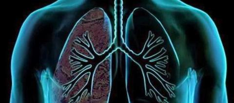 Μικροκυτταρικός καρκίνος του πνεύμονα