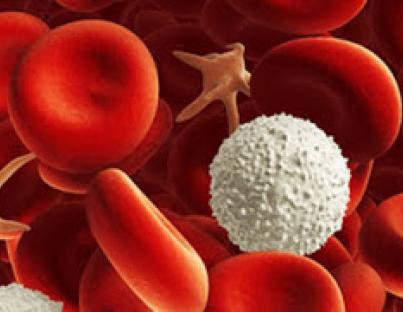 Οξεία μυελογενής λευχαιμία