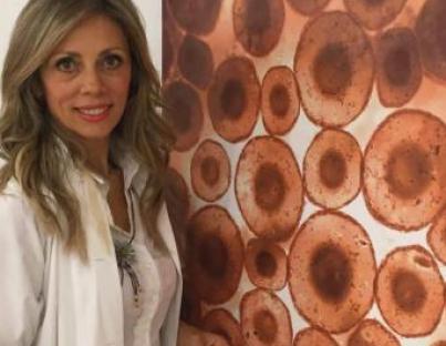 Κονδυλώματα : ένας θανάσιμος εχθρός