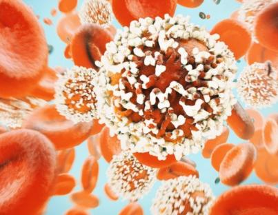 Καρκίνος στην χολή : όλα τα μυστικά