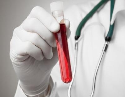 Ταχύτητα Καθίζησης Ερυθρών: Ποια εξέταση είναι και τι δείχνει