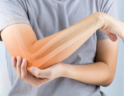 Τι πρέπει να ξέρετε για την οστεοπόρωση