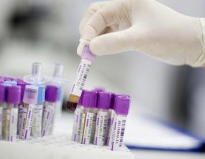 καρκινοεμβρυϊκό αντιγόνο- CEA