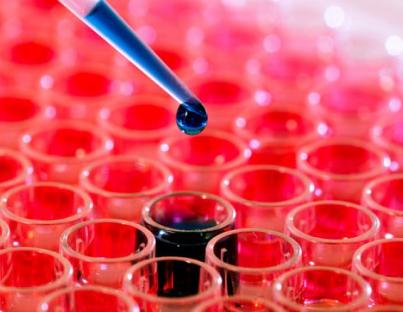 Τι σημαίνουν οι αιματολογικές σας εξετάσεις;