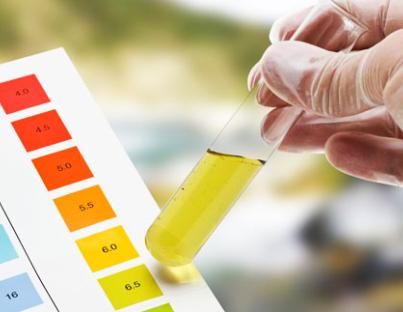 Εξέταση ούρων: Κάθε πότε πρέπει να γίνεται και γιατί