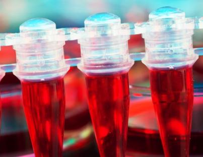 Γενική αίματος: Τι δείχνει 