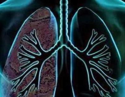 Μικροκυτταρικός καρκίνος του πνεύμονα