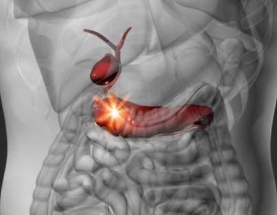 Ποια είναι τα σημάδια του καρκίνου στο πάγκρεας