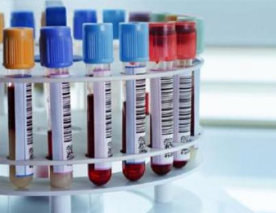 Καρκινικοί Δείκτες PSA, CΑ 19-9 ΟΡΟΥ, CA 125 ΟΡΟΥ, CA 15-3 ΟΡΟΥ