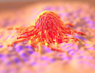 Κυκλοφορούντα καρκινικά κύτταρα