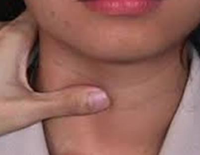 Καρκίνος του θυρεοειδούς: Μια ασθένεια που εντοπίζεται όλο και πιο συχνά  