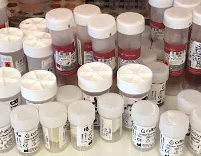 Κατευθυντήριες Οδηγίες για τη διασφάλιση ποιότητας του Προσυμπτωματικού Ελέγχου του Καρκίνου του τραχήλου της μήτρας: συστάσεις για τη συλλογή δειγμάτων συμβατικών και υγρής φάσης 