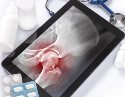 Οστεοσάρκωμα