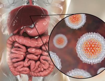 Ηπατίτιδα C