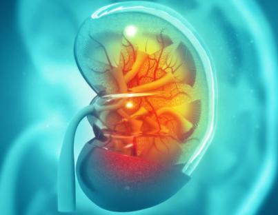 Καρκίνος των νεφρών