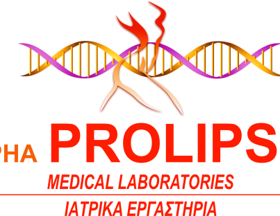 Παρακέντηση με λεπτή βελόνα (FNA) Μαστού