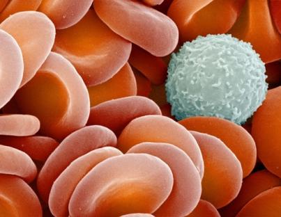 Λευχαιμίες 