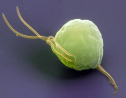 Τριχομονάδες