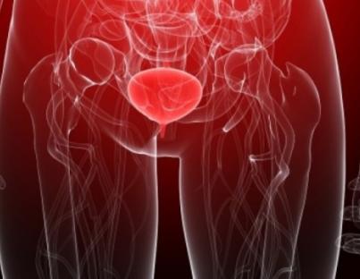 Ποια είναι τα συμπτώματα της ουρολοίμωξης. Πώς μπορείτε να την αντιμετωπίσετε