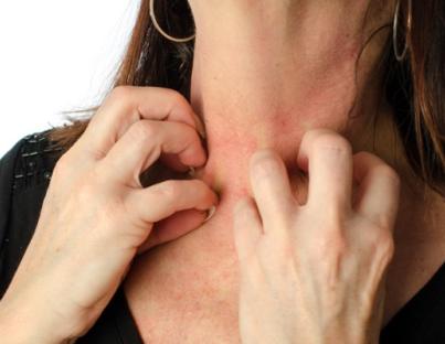 Δερματίτιδα εξ επαφής